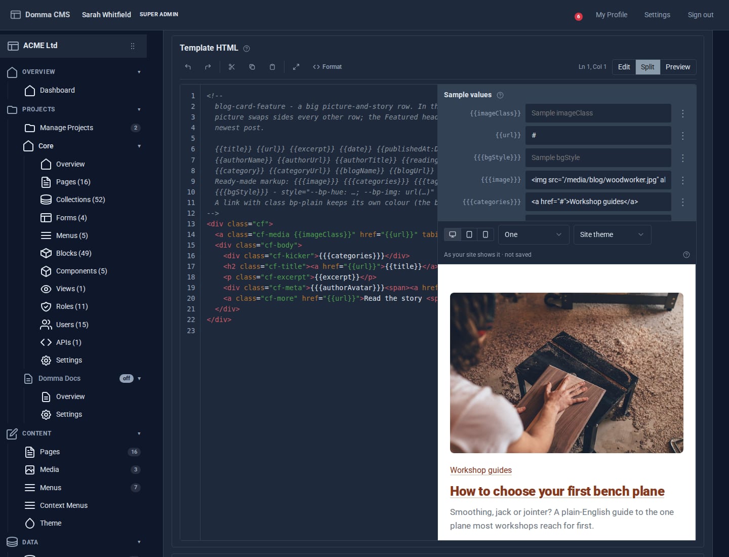 The block editor in Split mode: the blog-card-feature template on the left, sample values for each placeholder, and a live preview drawn in ACME Ltd's own site theme with a workshop photo, category, title and excerpt